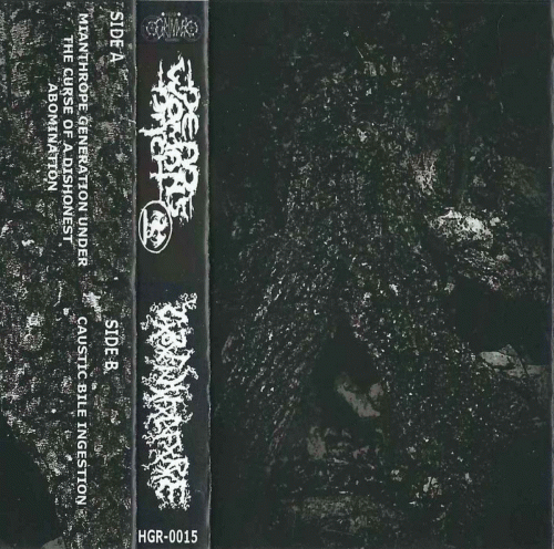 Catastrophic Blunt Force Intracranial Haemorrhage Fluid Leaking From Ruptured Eardrums : Dead Woman's Ditch - CxBxFxIxHxFxLxFxRxE